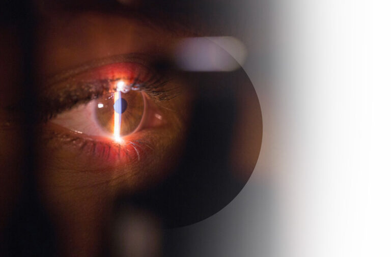 Supplemental Insurance example. Img: Close up of an eye getting an eye exam.